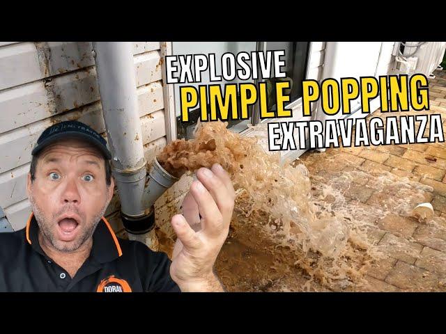 Blocked Drain 478: Explosive Pimple Popping Extravaganza